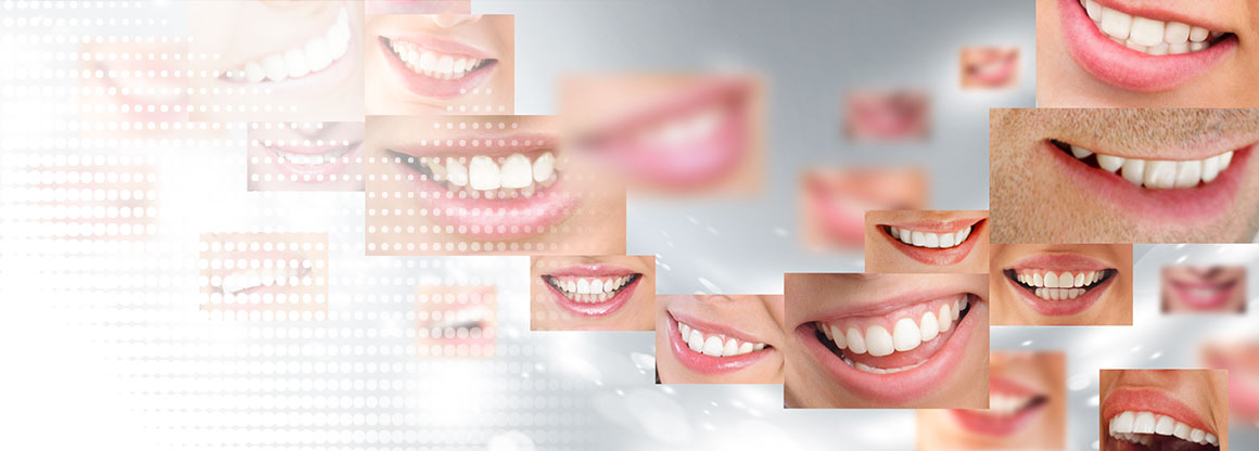 Collage schöner Zähne